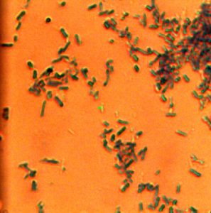 E coli bacteria under an optical microscope.